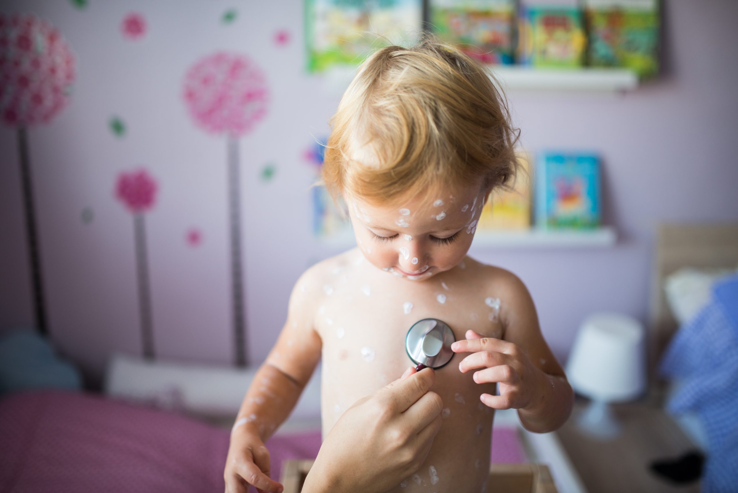 Little girl with chickenpox, antiseptic cream applied to rash